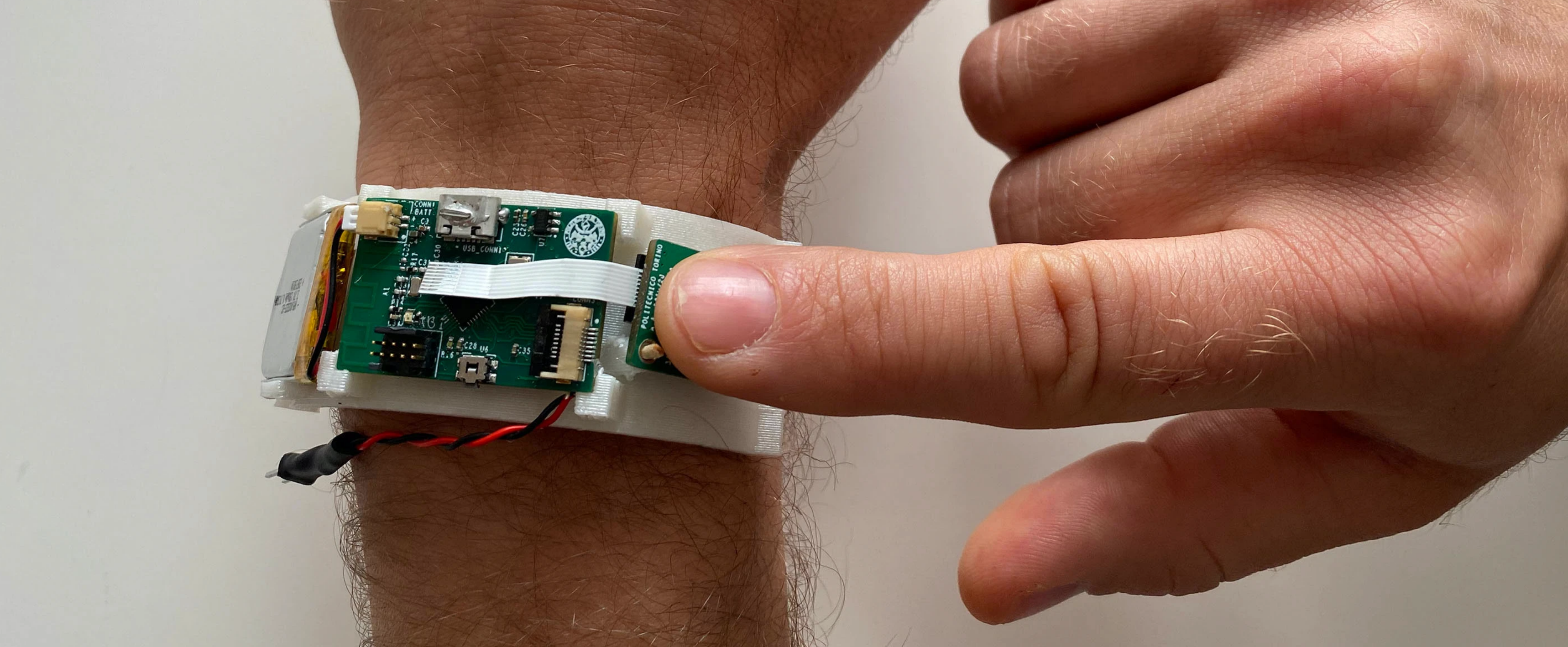 ECG enclosure