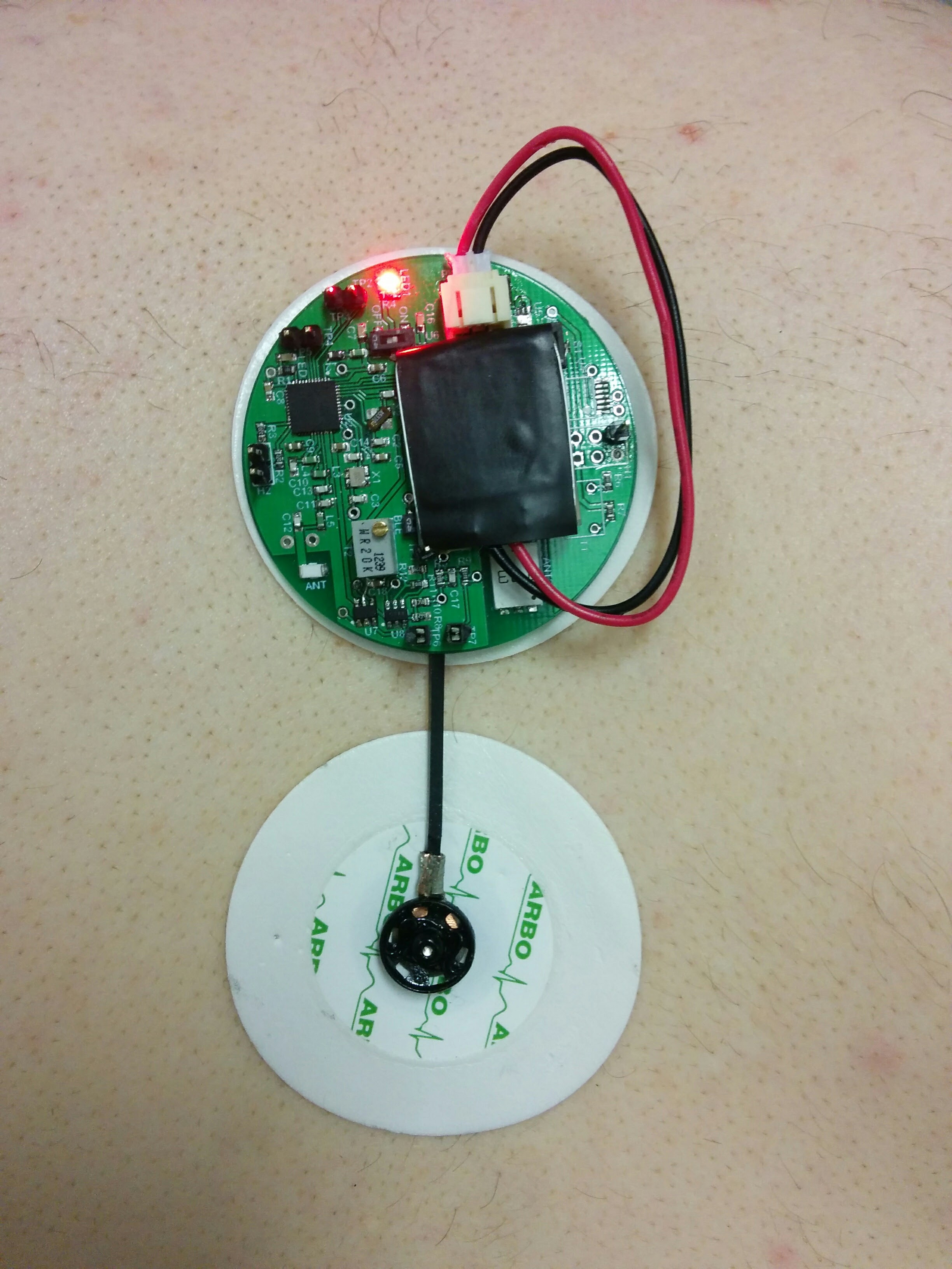 Spinal Elongation Monitoring sensor